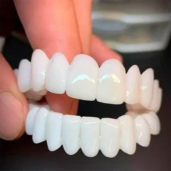 SmilePro 🦷 - Carillas Dentales Ajustables De Resina + ESTUCHE REGALO - ¡Últimas unidades! - Belezia Femina MX