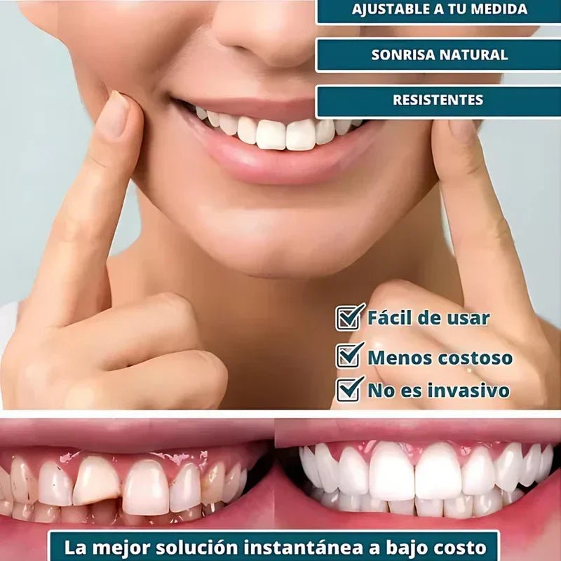 SmilePro 🦷 - Carillas Dentales Ajustables De Resina + ESTUCHE REGALO - ¡Últimas unidades! - Belezia Femina MX