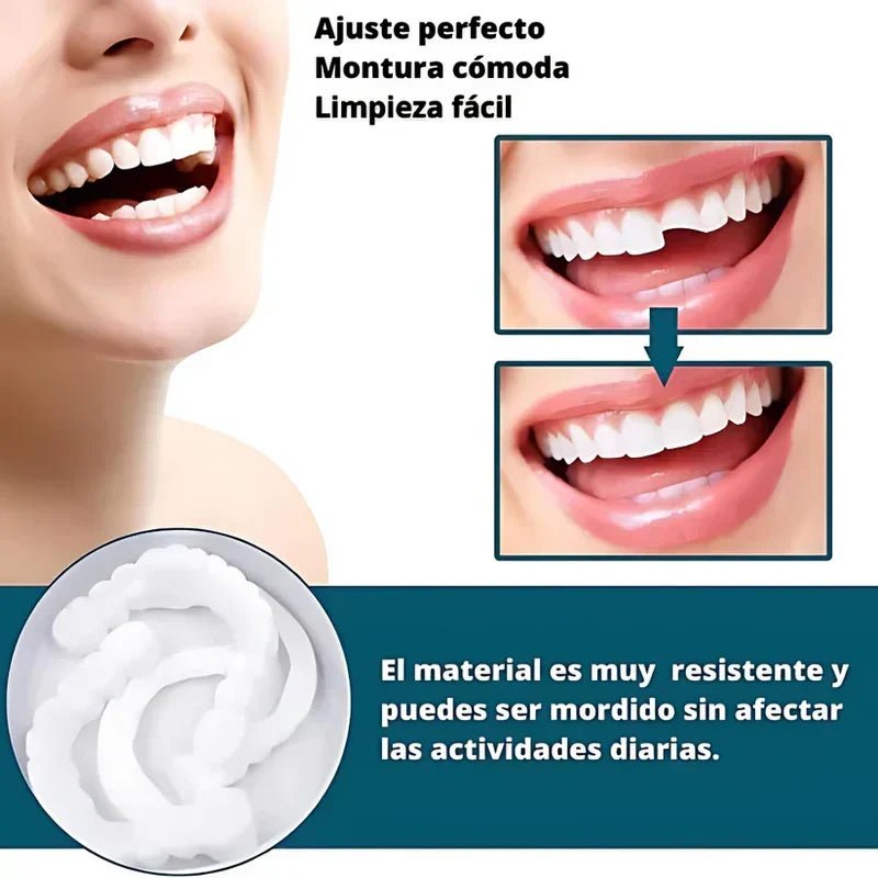 SmilePro 🦷 - Carillas Dentales Ajustables De Resina + ESTUCHE REGALO - ¡Últimas unidades! - Belezia Femina MX