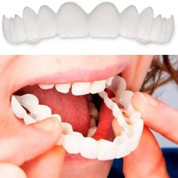 SmilePro 🦷 - Carillas Dentales Ajustables De Resina + ESTUCHE REGALO - ¡Últimas unidades! - Belezia Femina MX